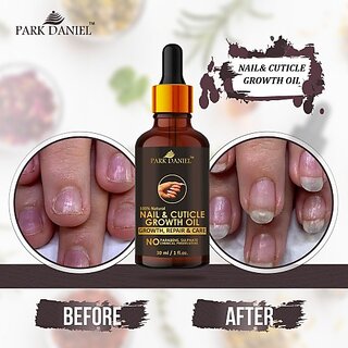 park daniel premium nail and cuticle growth oil for nail growth repair and cuticle care 30 ml yellow 